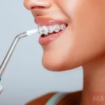 Как пользоваться ирригатором